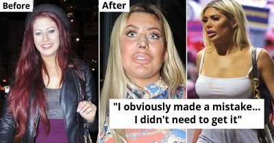 15 Celebrities Who Regretted Going Under The Knife For Beauty Procedures
