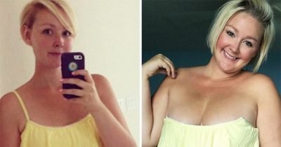 This Mom’s Stunning Before & After Photos Are Not What You Expect