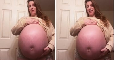 'My Baby Bump Is So Huge People Think There're Eight Kids Inside – But Scan Proves Not'