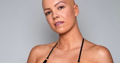 Meet First Bald Sports Illustrated Model Who Ripped Her Wig Off On Runway To Normalize Baldness In Women