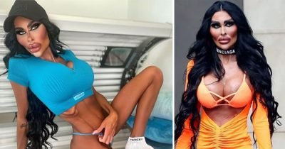 'Real-Life Barbie Doll' Flaunts $71K Plastic Surgery And B**b Job In New Snaps