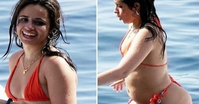 17 Celebs Who Are Not Afraid To Show Their Natural Body