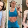 Nurse Believed She Had Sore Throat, But Her Body Turned Into A 'Leopard Print'