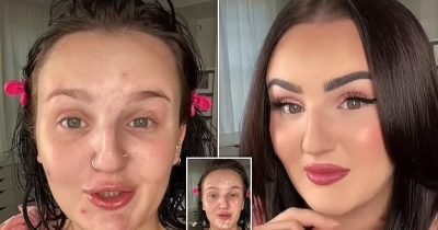 Makeup Artist Shows How To Perfectly Cover Acne Using The ‘Sticky Method’