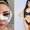 Model Who Spent $600k To Be Kim Kardashian Is Now Paying $120k To Look Herself Again