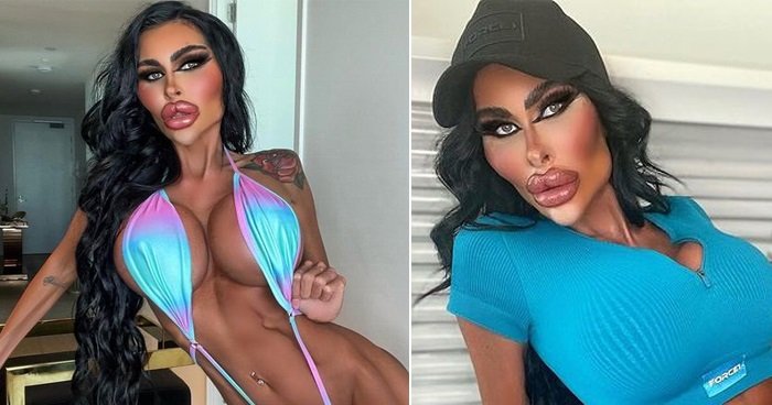 Australian 'Barbie' Shows Her Poutiest Yet Lips After A New Enhancement