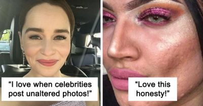 30 Times Instagrammers Showed Their ‘Real Bodies’ And The Internet Admired The Honesty