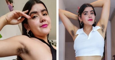 35 Women Who Have Embraced Their Body Hair With Confidence
